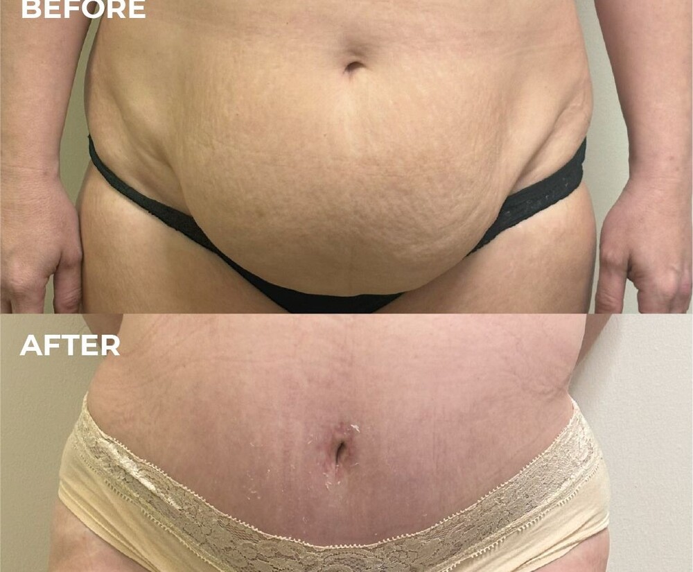 Clinic Results Gallery